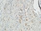 MMP-2 Polyclonal Antibody